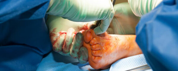 Chirurgien du pied